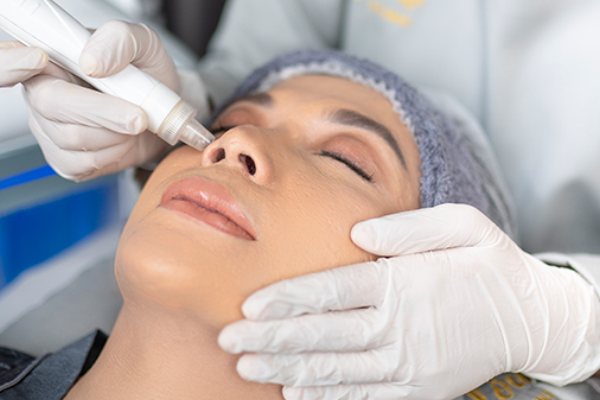 Facial Hydra Acne